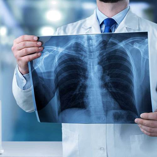 X - Ray in Panvel